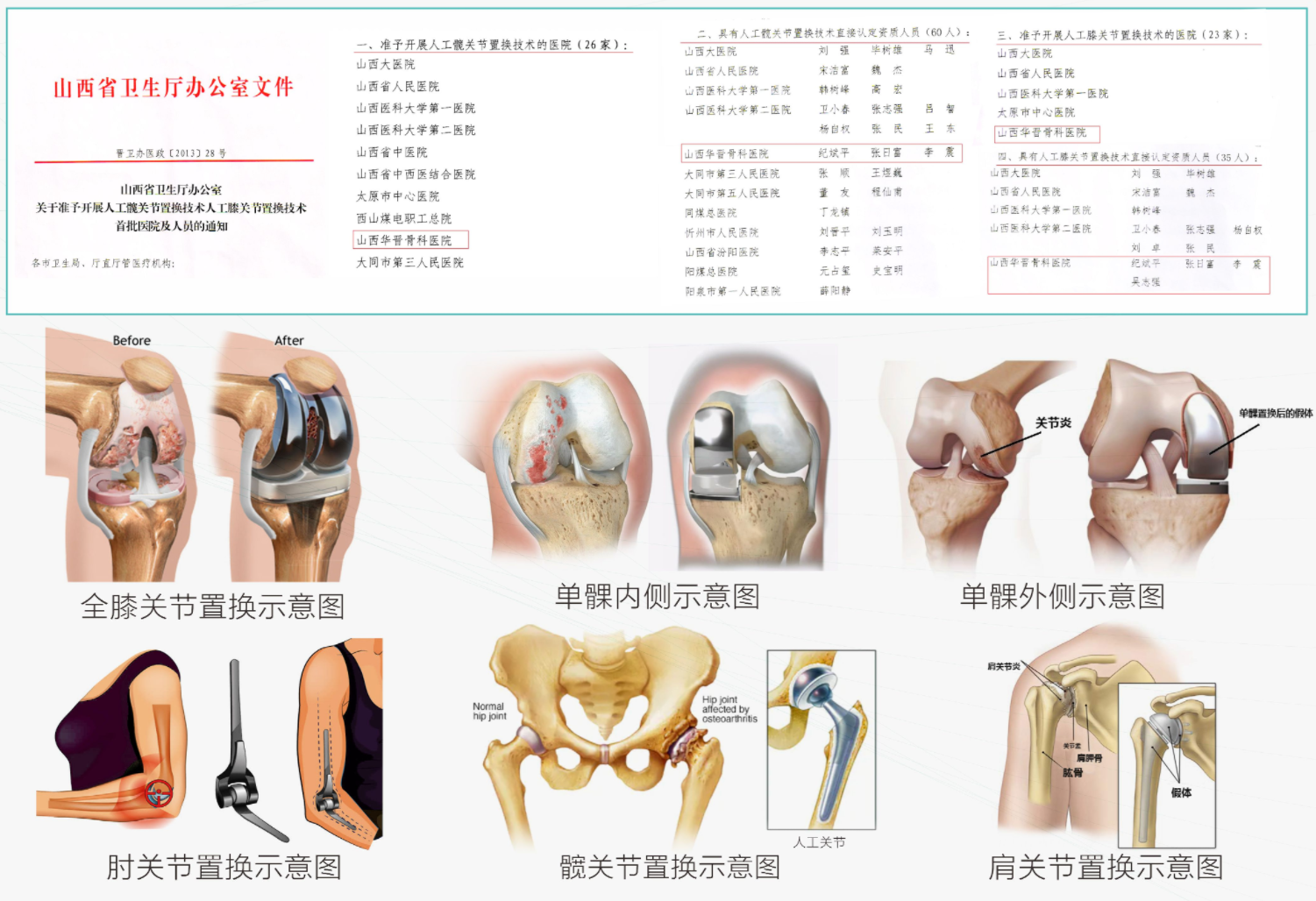 山西华晋骨科医院关节科